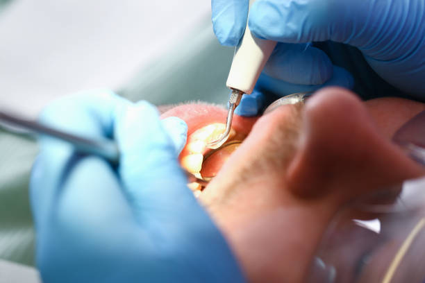 Best Urgent Care for Lost Fillings or Crowns in River Park, FL