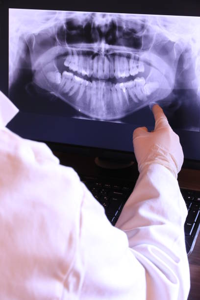 Best Emergency Treatment for Dental Infections or Abscesses in River Park, FL