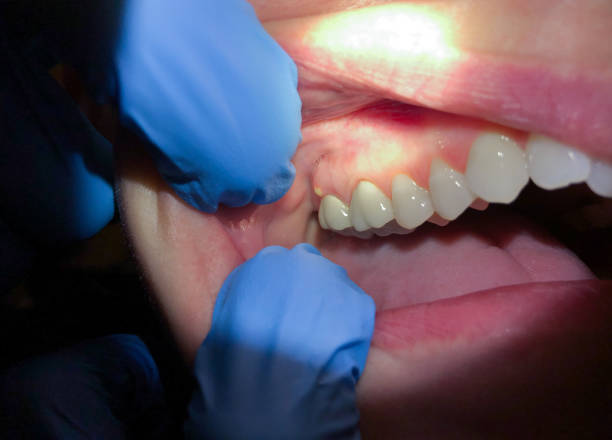 Best Same-Day Emergency Dental Services in River Park, FL